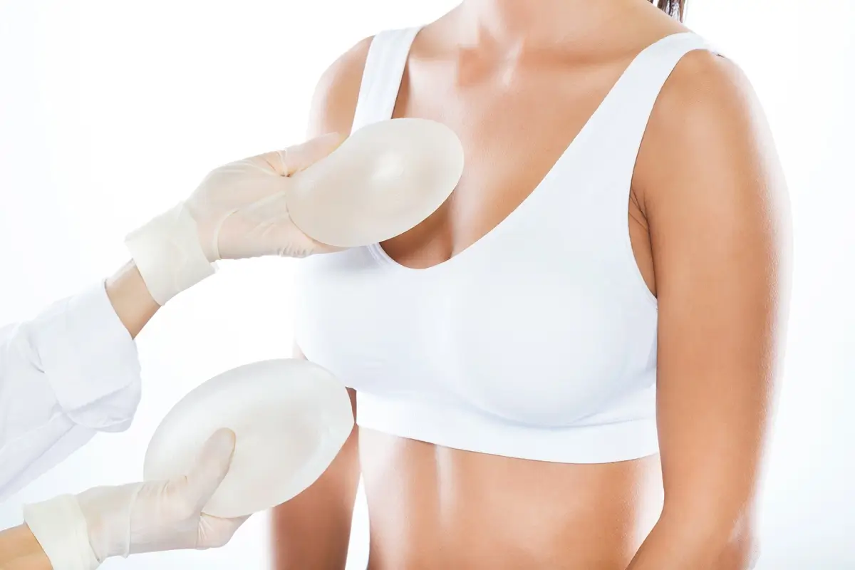 Custom Breast Lift with Implant Exchange