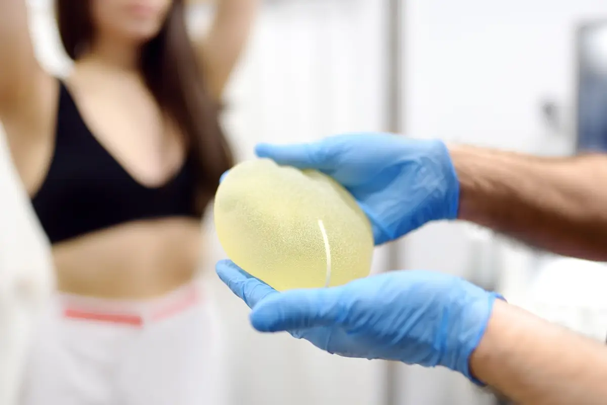 Breast Lift with Implants in Winter Park & Celebration, FL
