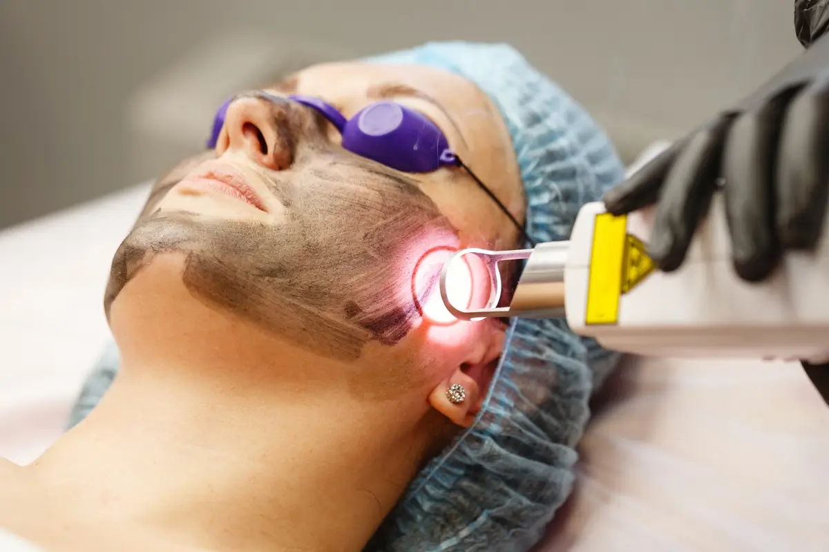 UltraClear Laser Skin Renewal in Celebration, FL | IAS