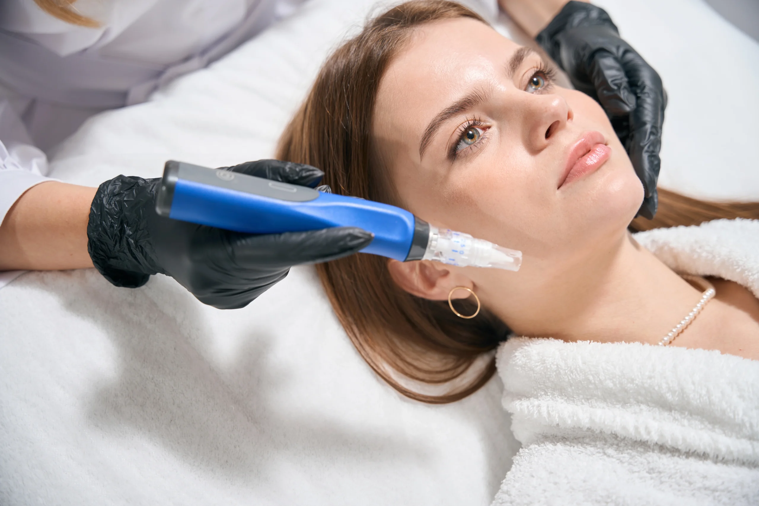 SkinPen® Microneedling in Winter Park, FL: Renew, Tighten, & Rejuvenate Skin