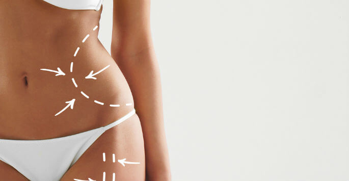 power-assisted liposuction